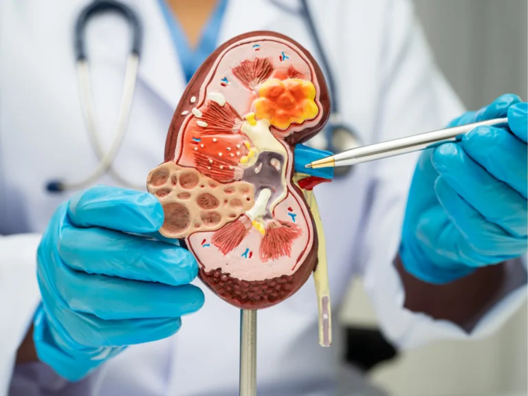 The Role of Nephrologists: What They Do and When to See One