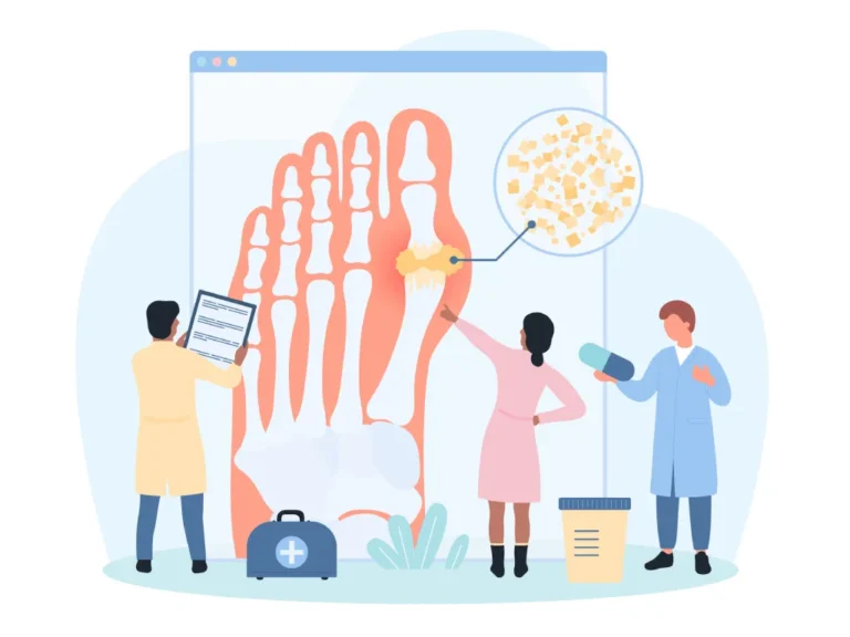 Why Gout Happens: The Kidney Connection and Prevention Tips