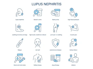 Lupus Nephritis – How Lupus Affects the Kidneys