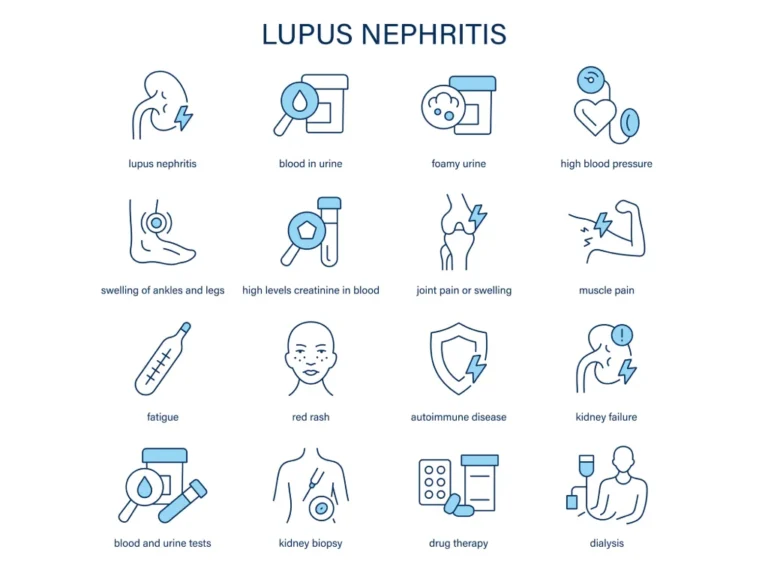 Lupus Nephritis – How Lupus Affects the Kidneys